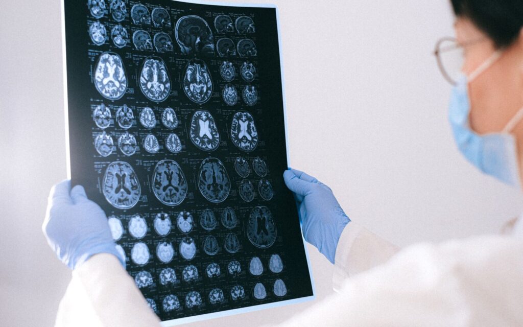 FDA approves Donanemab for early symptomatic Alzheimer’s disease FDA approval