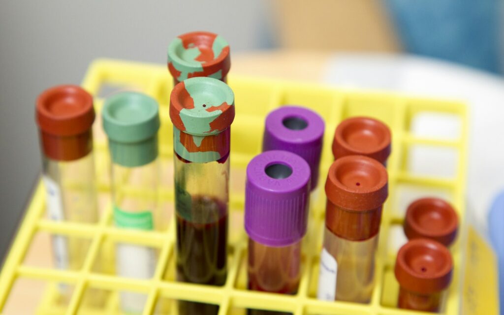Blood sample vials used for laboratory DNA testing