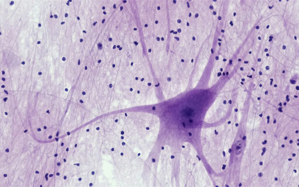 Experimental multiple sclerosis drug reverses paralysis and vision loss in mice