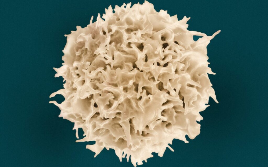 One dose of CAR-T cells shrinks solid tumors in preclinical study
