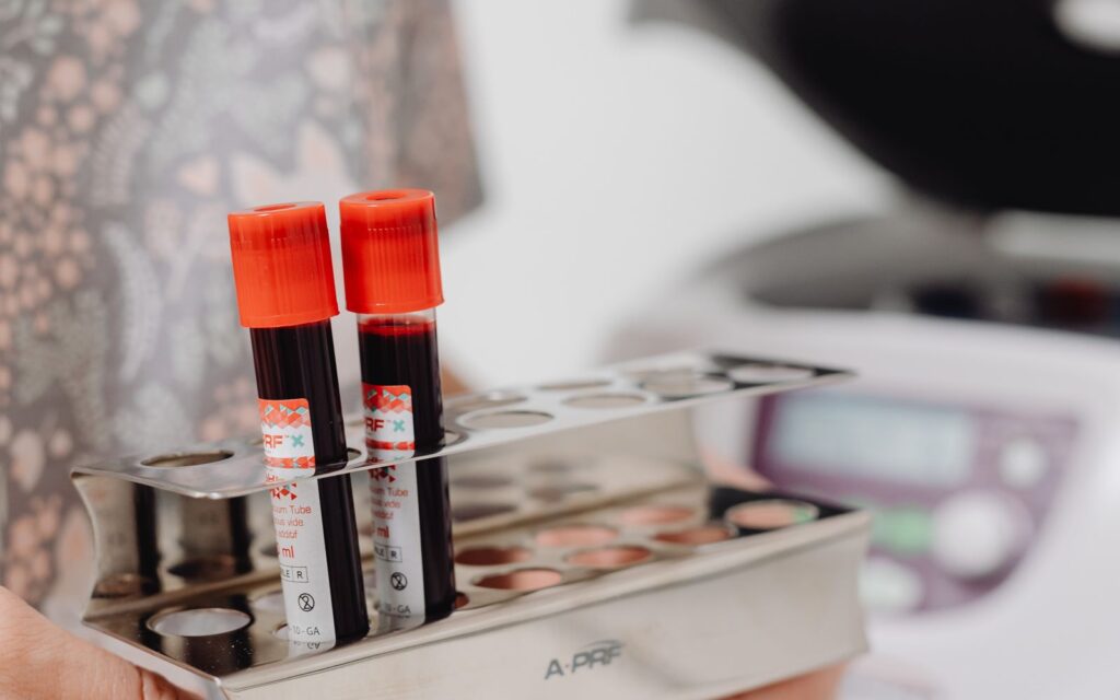 Can ctDNA testing detect colorectal cancer recurrence before scans?