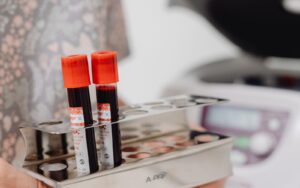 Can ctDNA testing detect colorectal cancer recurrence before scans?