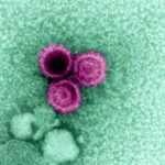 Epstein-Barr virus reactivation precedes MS relapse: what the new study found