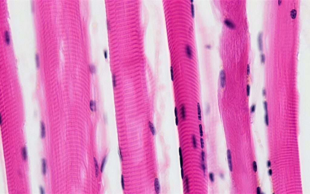 Histology micrograph of skeletal muscle fibers, the tissue examined in the Miro1 insulin-resistance study