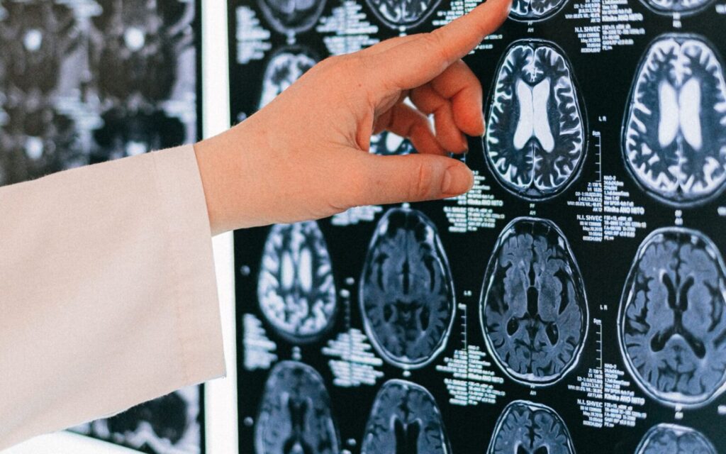 New research identifies a brain circuit implicated in OCD