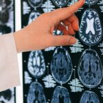 New research identifies a brain circuit implicated in OCD