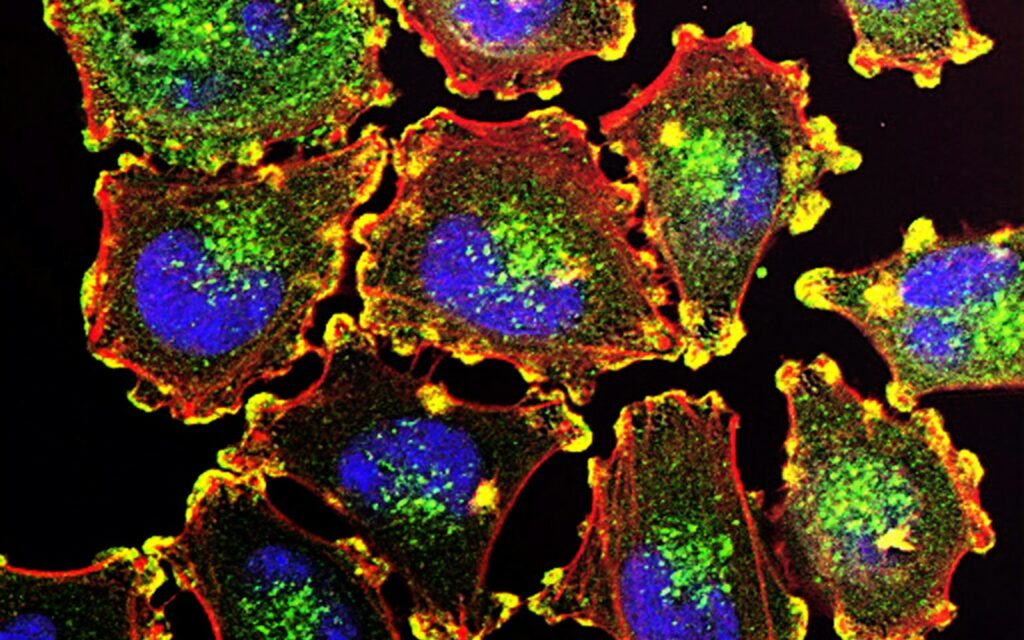Cancer-promoting protein helps engineered T cells fight tumors in mice